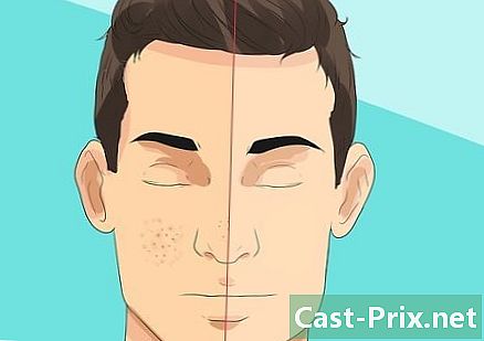 Πώς να καθαρίσετε το πρόσωπό του σχολαστικά