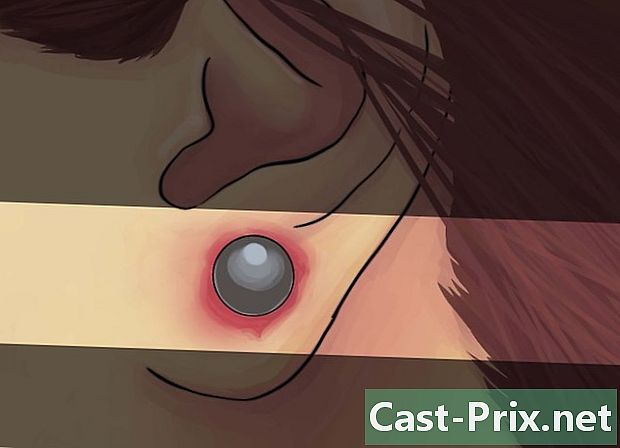Jak vyčistit infikovaný piercing do ucha - Vodítka