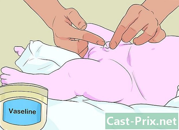 Com netejar un penis després d’una circumcisió - Guies