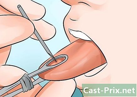 Hur du tar hand om din piercing på tungan