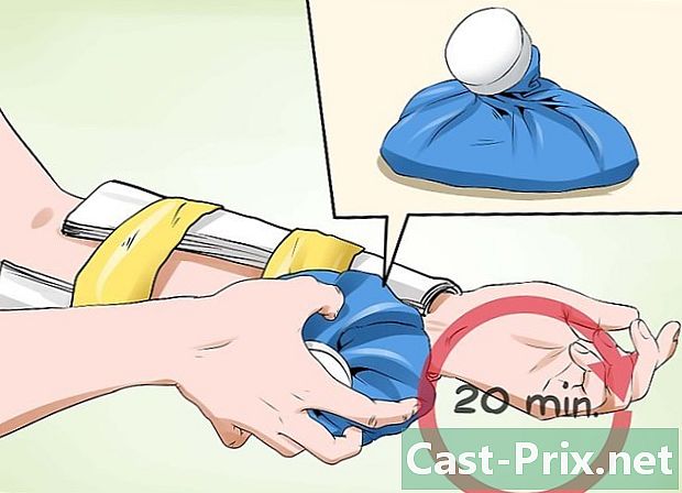 Как да се грижим за фрактура на ръката