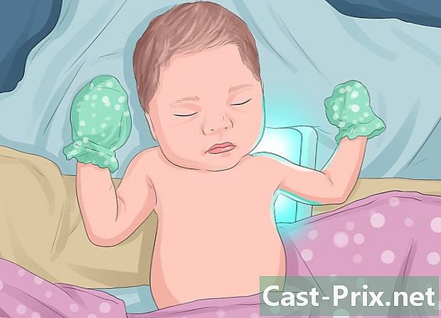 Как предотвратить желтуху у новорожденных