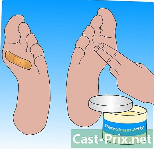 Hur man förhindrar blåsor på dina fötter - Guider