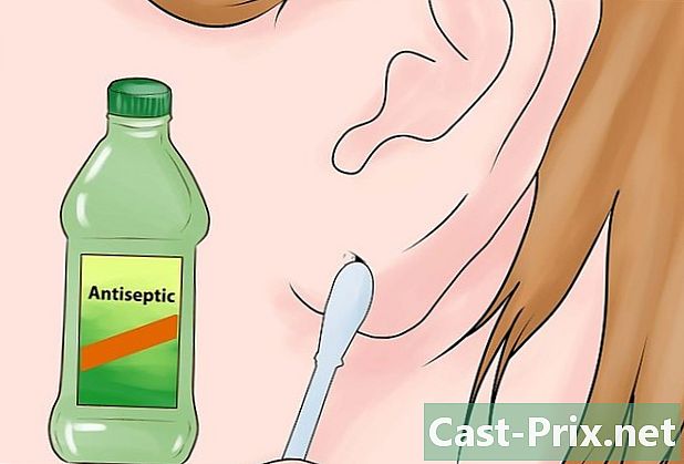 Ako znížiť roztiahnuté ušné lalôčky - Vodítka