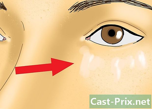 Cách giảm sưng mắt sau khi khóc