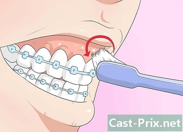 Cómo reducir el dolor causado por el aparato dental - Guías