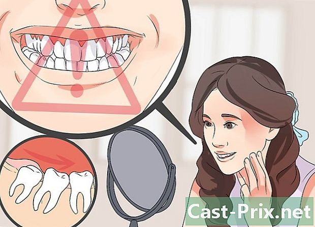Bilgelik diş döküntüleri tanımak nasıl