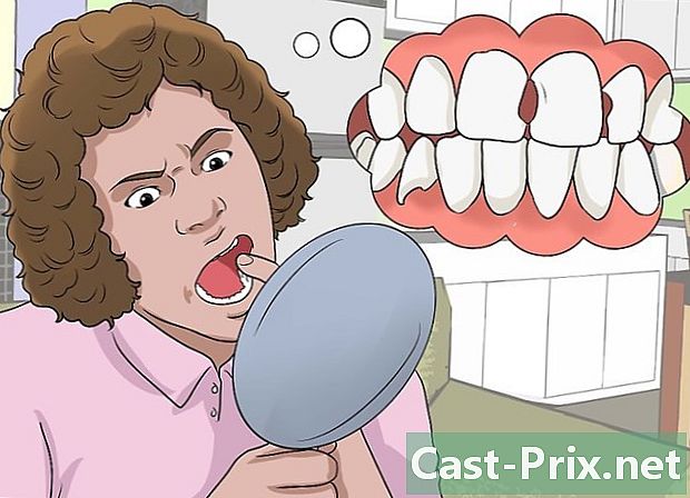 Hogyan lehet felismerni a fogak elvesztését? - Útmutatók