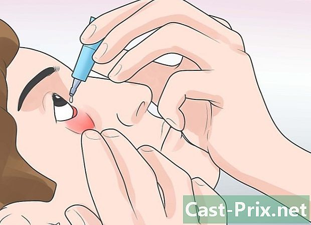 Kako prepoznati očesno cista