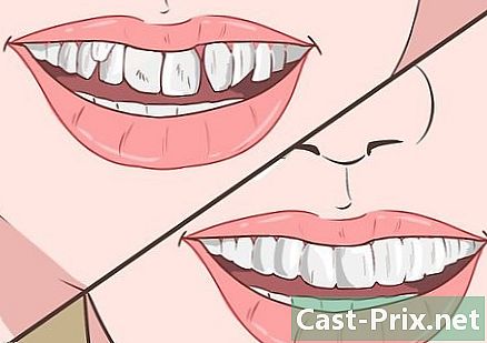 बिना रिंग पहने अपने दांतों को सीधा कैसे करें