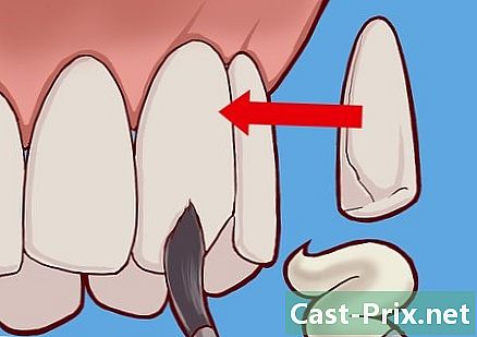 歯のエナメル質を強化する方法