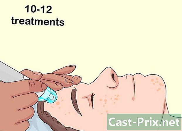 Como remover permanentemente os pêlos faciais - Guias