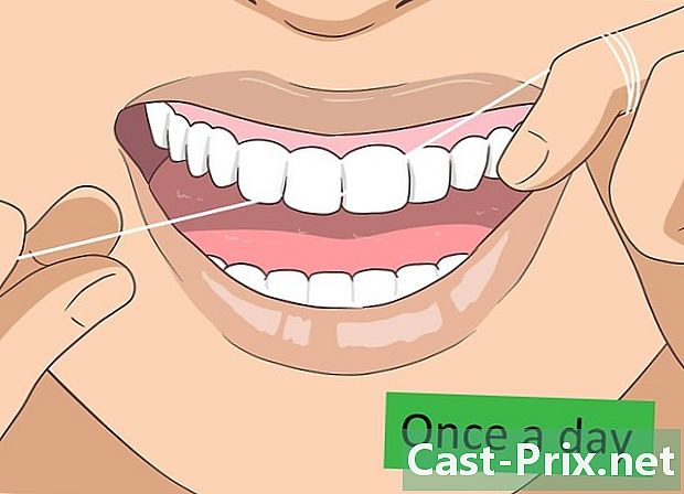 Sådan fjernes tandsten - Guider