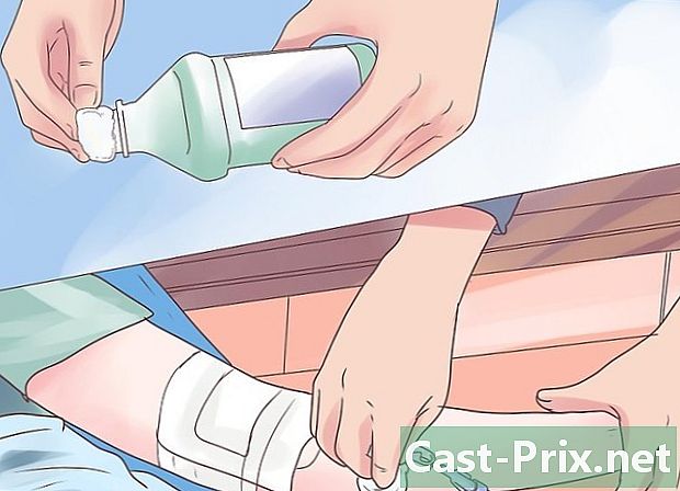 Cómo extraer un catéter central periférico - Guías