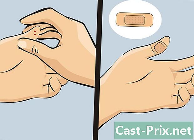 Cara menghapus kail dari jari Anda