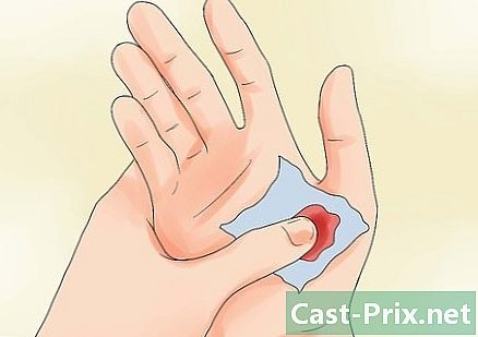 Hvordan fjerne en bandasje uten smerter