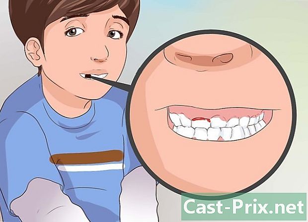 Hur man tar bort en tand