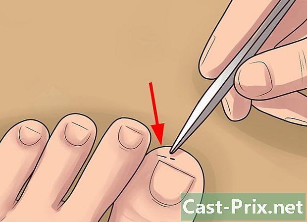 Como remover um espinho