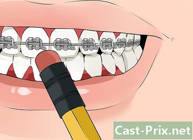 Πώς να διορθώσετε ένα σπασμένο σύρμα σε μια οδοντιατρική συσκευή - Οδηγοί