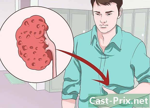 Come sapere se hai problemi ai reni