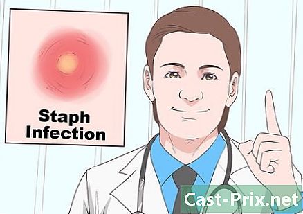 Como saber se você tem estafilococos