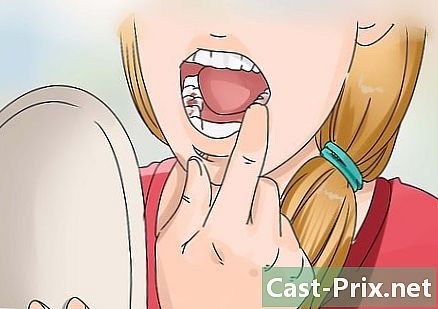 Làm thế nào để biết nếu bạn có sâu răng