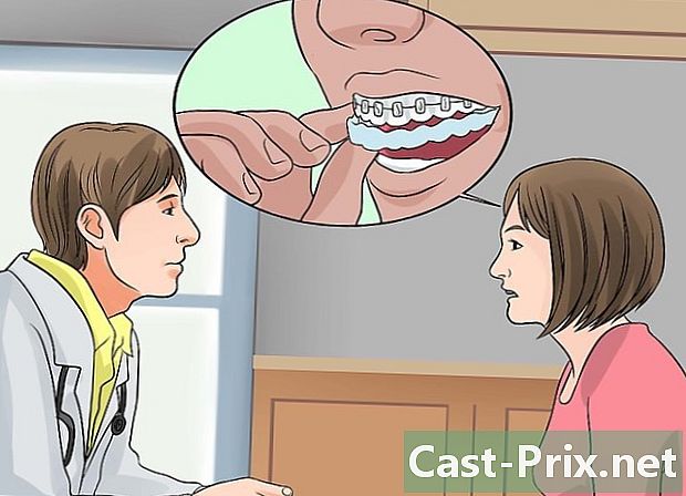 歯科用リングを着用したときに歯を白くする方法
