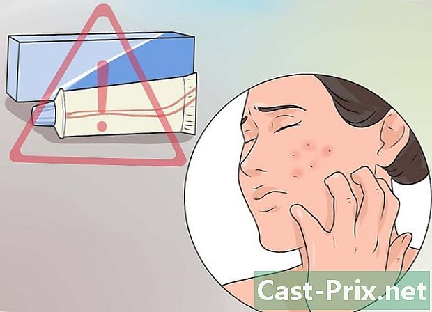 Como se livrar da acne grave