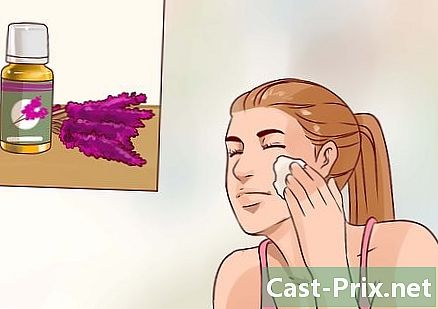 Sådan slipper du af med naturlige acne-ar
