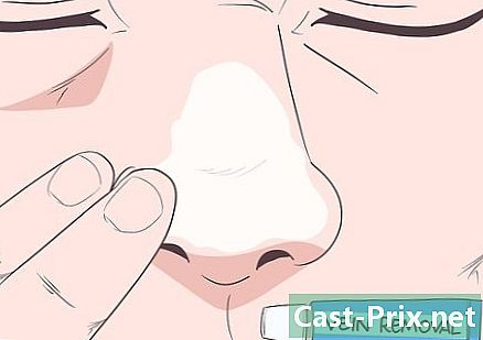 코에 telangiectasias를 제거하는 방법