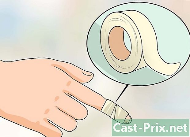 Како се ријешити брадавица на прстима
