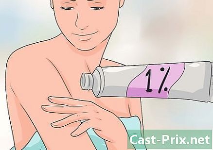 Como se livrar de uma queimadura de coceira (pele clara)