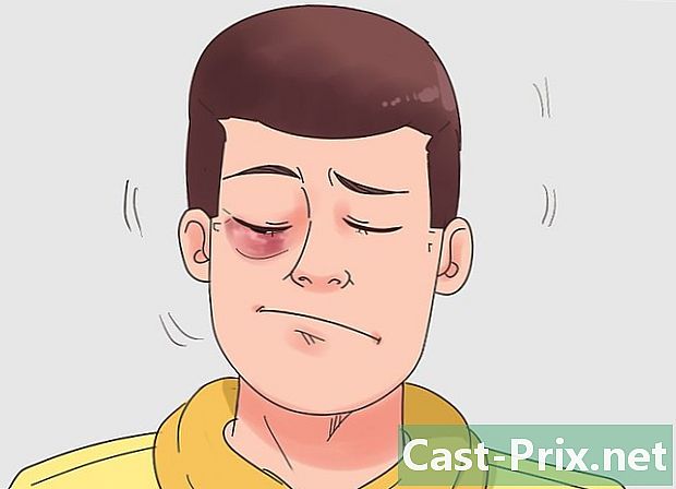 Ako sa zbaviť čiernych očí - Vodítka