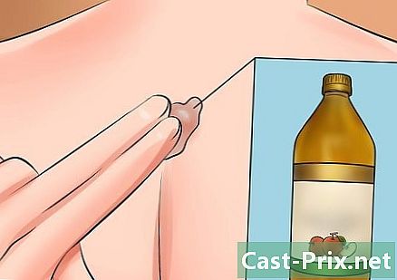 Hvordan bli kvitt en cyste i ryggen