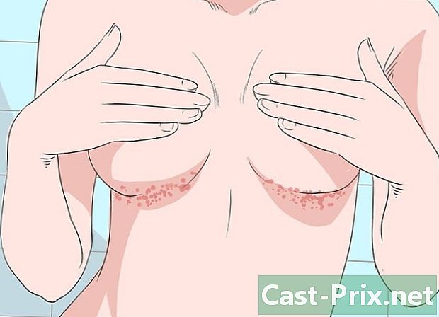 Hvordan bli kvitt et utslett under brystene