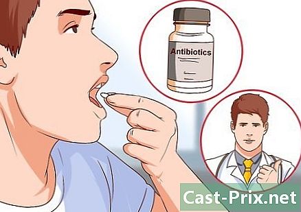 Hoe snel van laryngitis af te komen