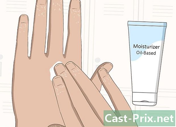 Ako liečiť popraskané prsty - Vodítka