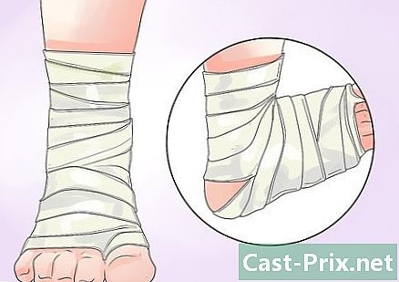 Hvordan man behandler tørre fødder - Guider