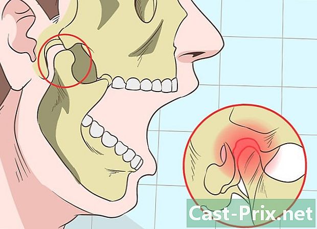 Cum se tratează în mod natural trismusul - Ghiduri