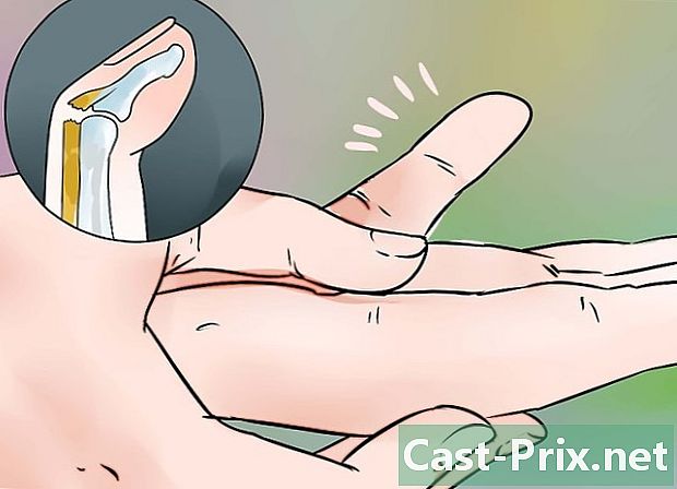 Как да се лекува удар с чук