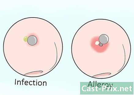 Как лечить пирсинг носа и избежать инфекции