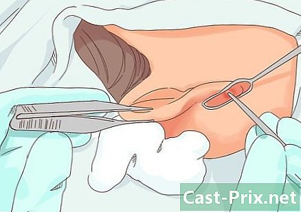 Hvordan behandle en infisert piercing i øret - Guider