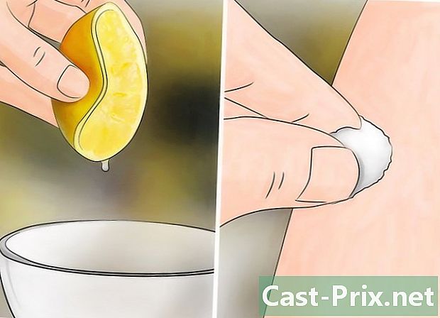 Jak ulevit kousnutí komára - Vodítka