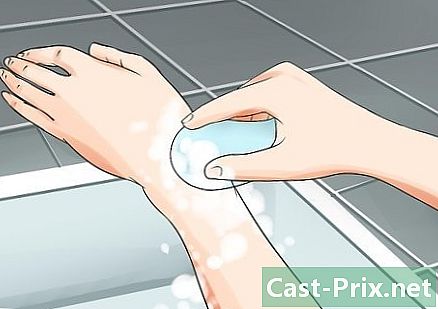 Cómo tratar las picaduras de brulots - Guías
