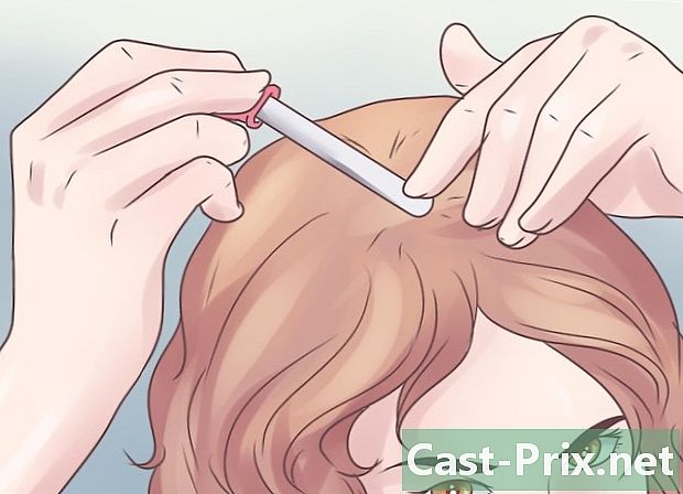 Kā ārstēt matu izkrišanu sievietēm