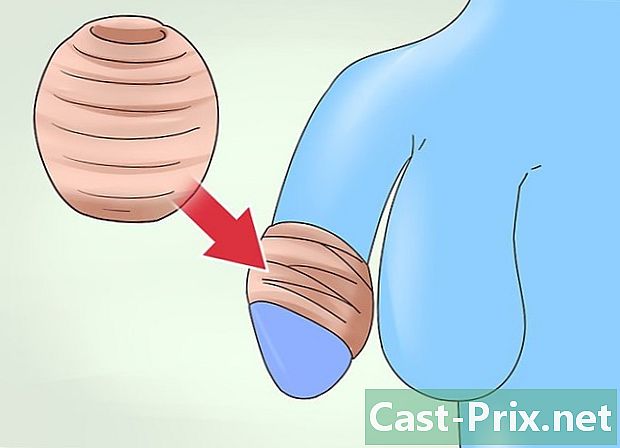 Jak zacházet s fimózou s protahováním prstu - Vodítka
