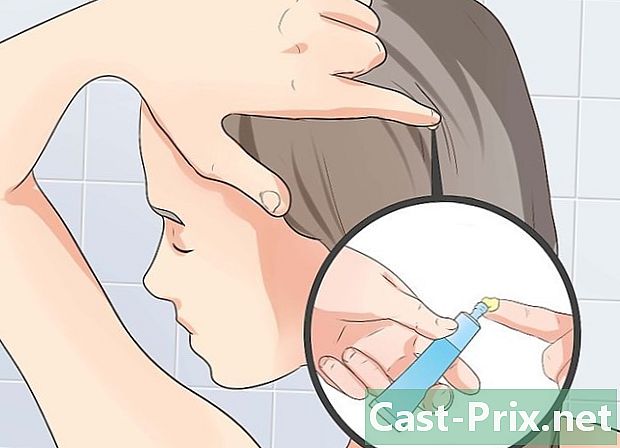 Cómo tratar las espinillas en el cuero cabelludo - Guías