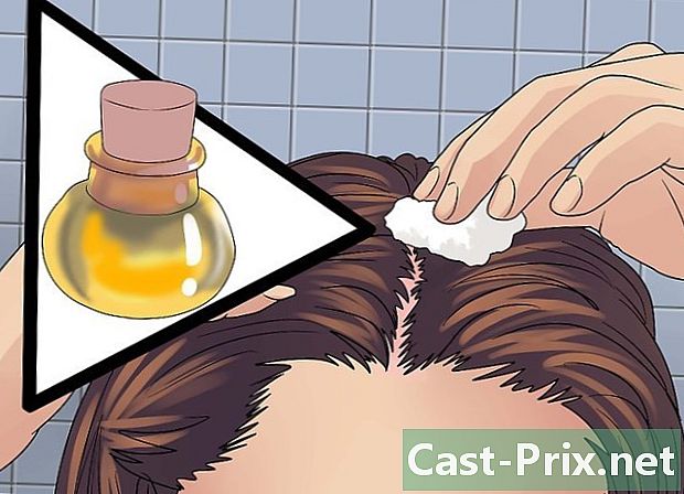 Cómo tratar una quemadura solar del cuero cabelludo