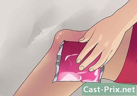 Como tratar um higroma