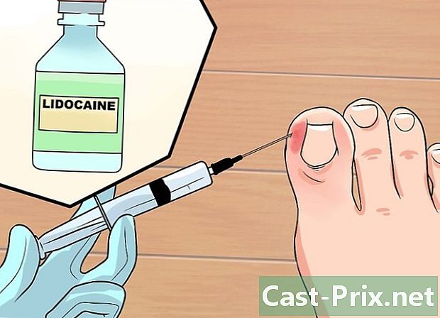 كيفية علاج اصبع القدم المصابة